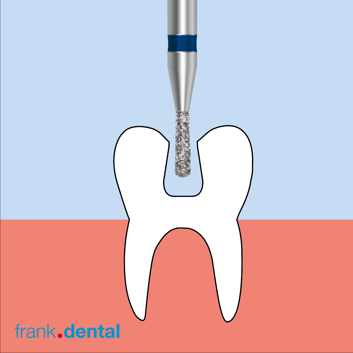 D.830L.010.FG